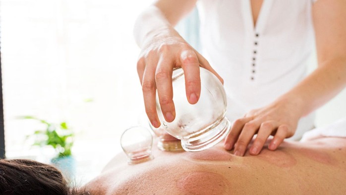Ventosas (Cupping)